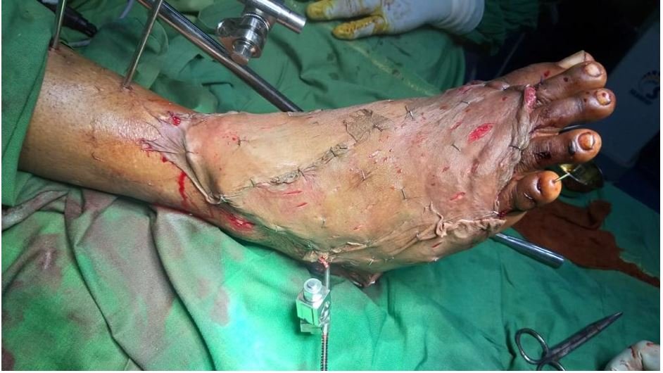 Patient recovery progress