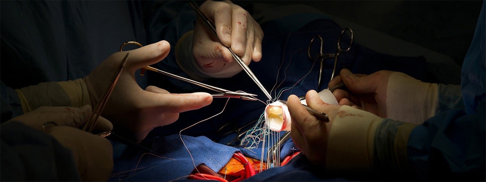 Cardiothoracic and Vascular Surgery